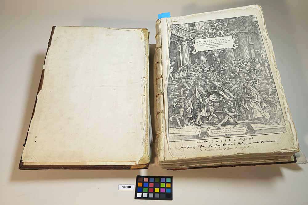 De Vesalius uit de Enkhuizer Librije